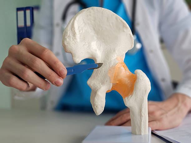 Illustration of hip replacement surgery and joint arthroplasty relevant to recovering at home