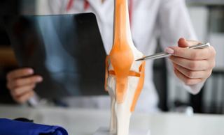 Doctor examining an X-ray beside a knee joint model, comparing physiotherapy and surgery for knee osteoarthritis