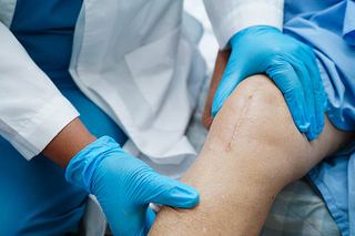 Doctor checking an elderly patient's knee replacement surgery scar during post-operative recovery at home