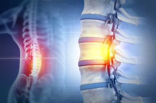 3D illustration of the spinal cord and vertebrae highlighting recovery after spinal surgery